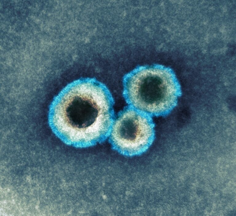 hMPV virus